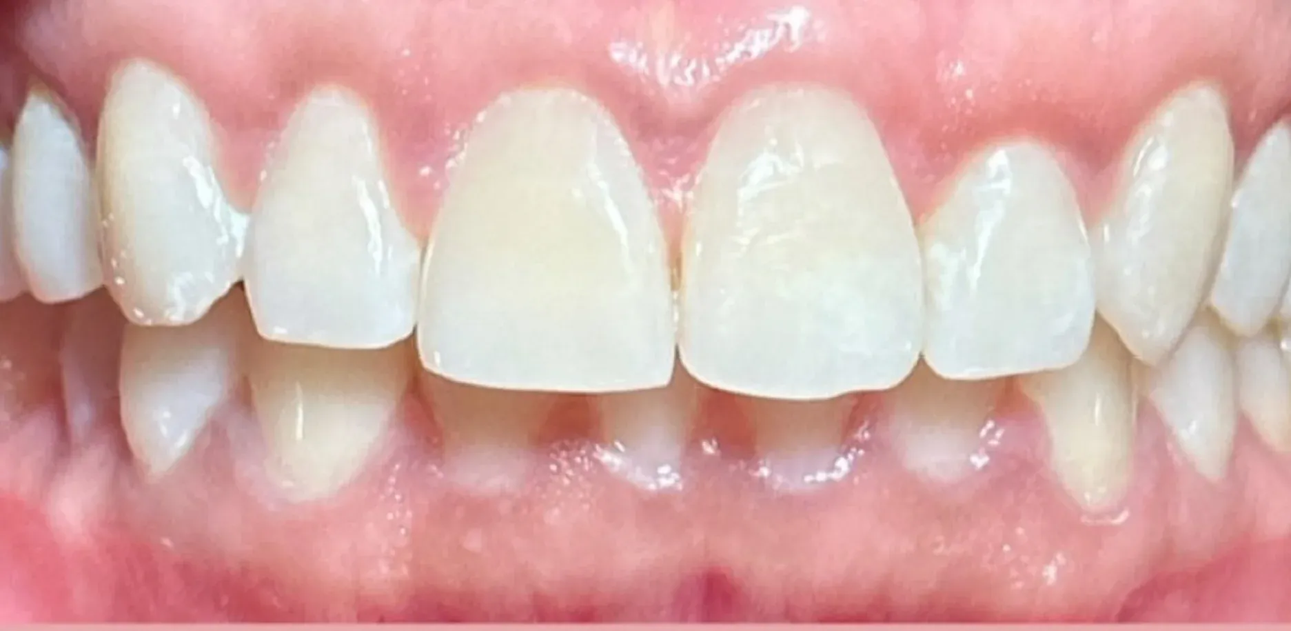 After: Dramatic Transformation